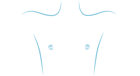  Ausencia de volumen mamario